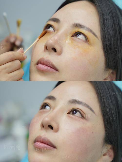 深圳睛睛医疗美容诊所预约挂号方式