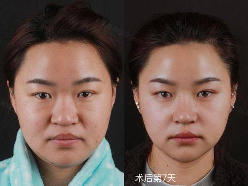 成都亚鑫医疗美容诊所地址电话及营业时间