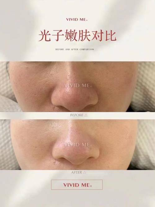 合阳县柠檬树整形医院口碑评价