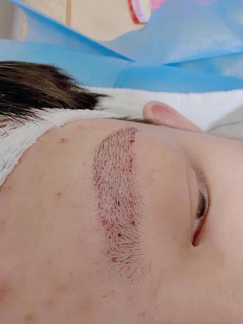 合阳县柠檬树整形医院预约挂号方式