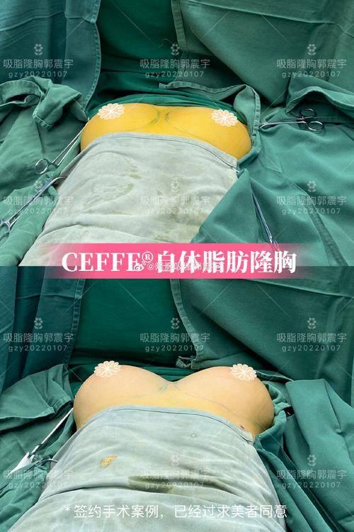 福州隆美尔整形医院价格表