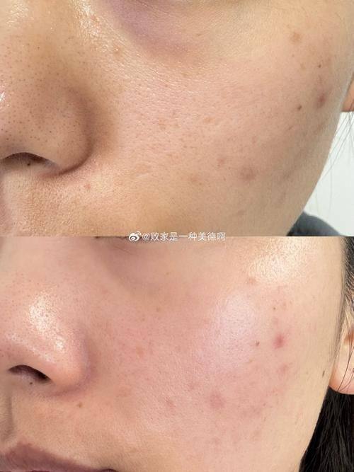 合阳县柠檬树整形医院擅长项目：