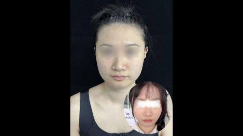 黄山百魅生医疗美容门诊部地址电话及营业时间：