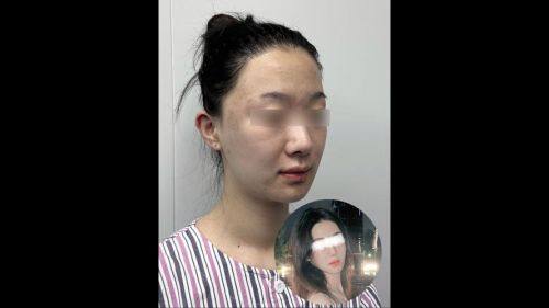 黄山百魅生医疗美容门诊部口碑评价：