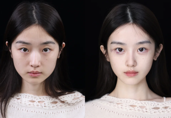 烟台美神诊所擅长项目