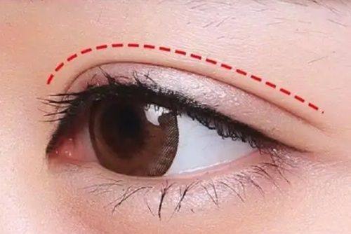 长沙姿尔美整形医疗美容门诊部怎么样