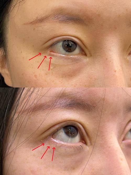 长沙姿尔美整形医疗美容门诊部地址电话及营业时间