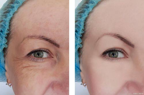 广州丽港丽格医疗美容怎么样？