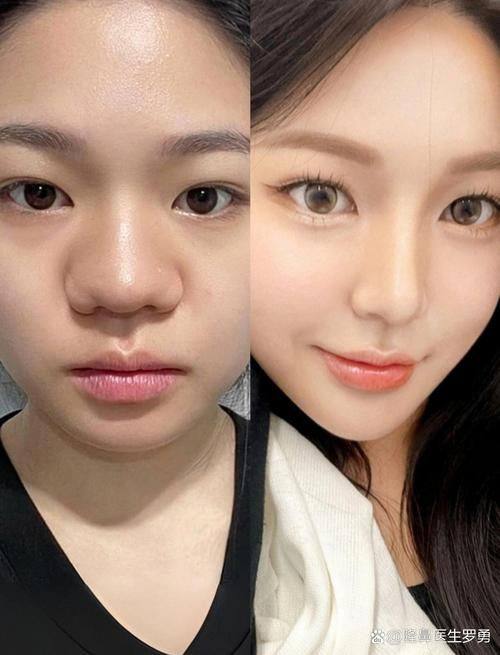 广州信永医疗美容门诊部擅长项目：