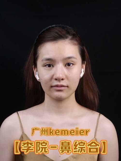 广州丽港丽格医疗美容医生名单及擅长领域：