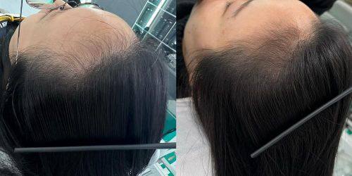 苏州名仕医院植发科口碑评价