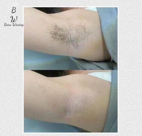 苏州名仕医院植发科怎么样？