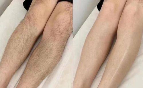 广州丽港丽格医疗美容价格表：