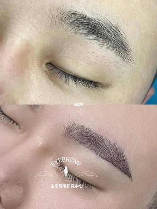 西安普莱蒂医疗美容门诊部医生名单及擅长领域：