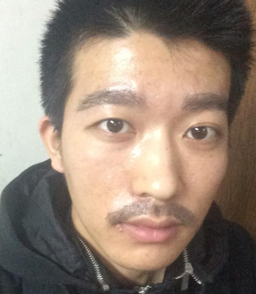 苏州名仕医院植发科医生名单及擅长领域：