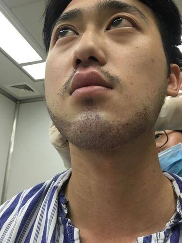 苏州名仕医院植发科预约挂号方式