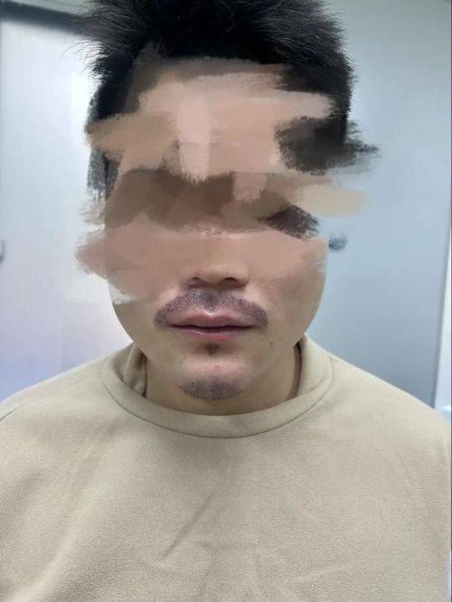 泉州碧莲盛植发医院地址电话及营业时间