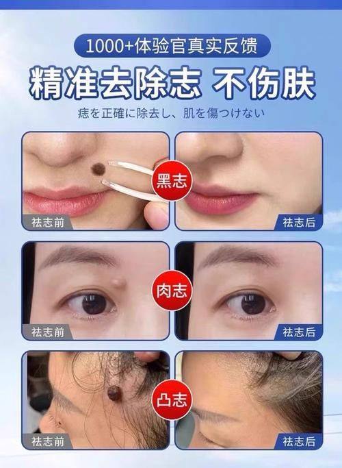 西安普莱蒂医疗美容门诊部擅长项目：