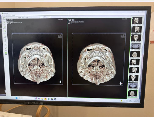 银川皓贝齿科诊所预约挂号方式