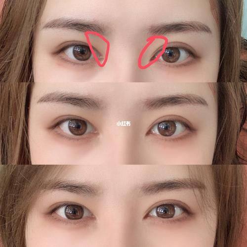 沈阳浑南丽格医疗整形美容预约挂号方式：