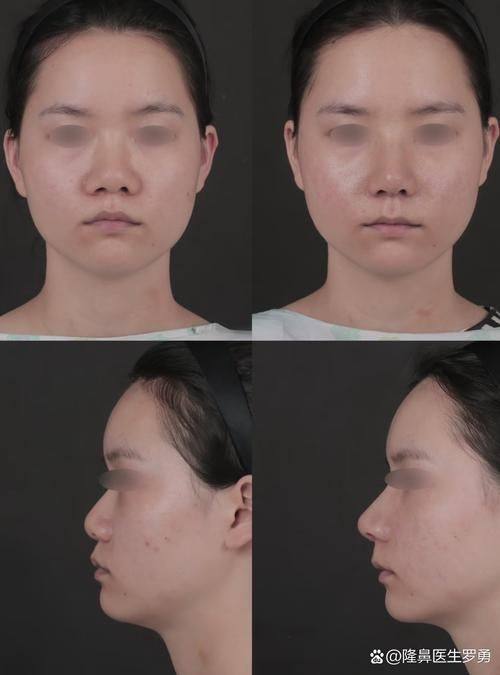 南京华美医疗美容怎么样？