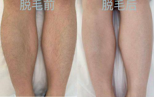 青岛得亚莉医疗美容诊所口碑评价：