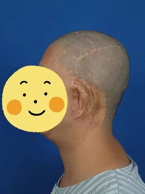 长春金玫瑰整形医疗美容预约挂号方式：