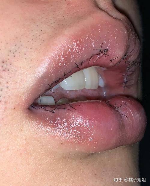 武汉爱尚美容医院擅长项目：