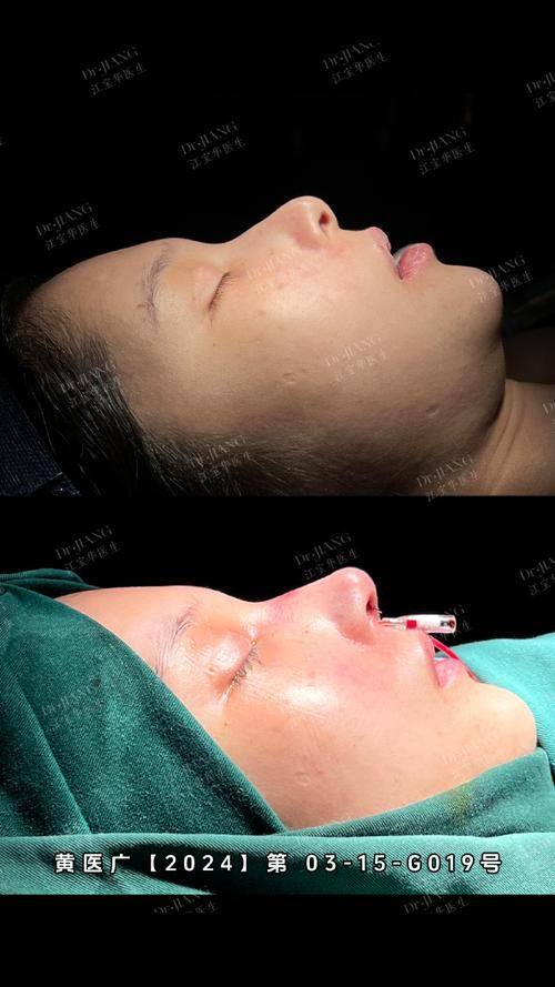 长春金玫瑰整形医疗美容价格表：