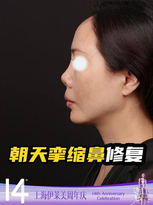 沈阳浑南丽格医疗整形美容擅长项目：