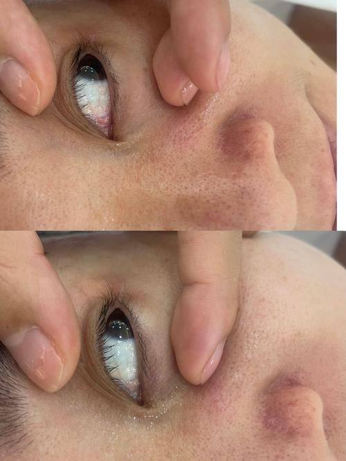 韩国cooki 整形外科医院擅长项目