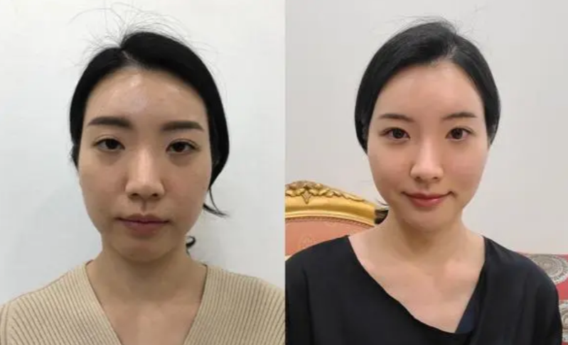 韩国cooki 整形外科医院预约挂号方式