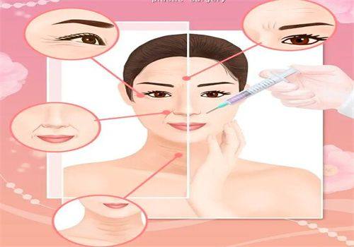 五、分类型针对性改善:精细解决不同眼周问题