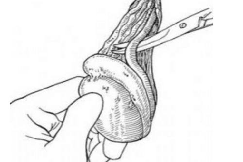 五、面部吸脂后变老了怎么办？科学应对方案