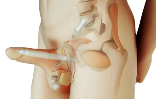 二、日常护理:轻微眼周问题的至佳妙招