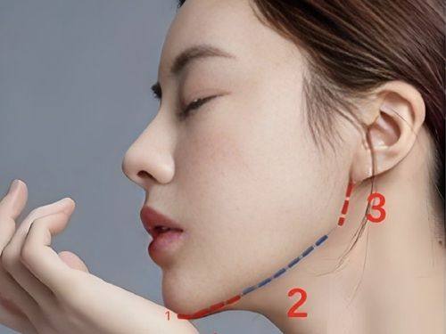 四、隆胸手术的常见后遗症:短期不适与长期隐患并存