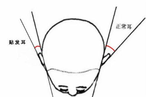 四、打除皱针对身体有副作用吗?多数情况下影响局限