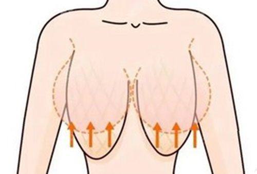 三、不当注射的隐患:多种重度副作用与后遗症