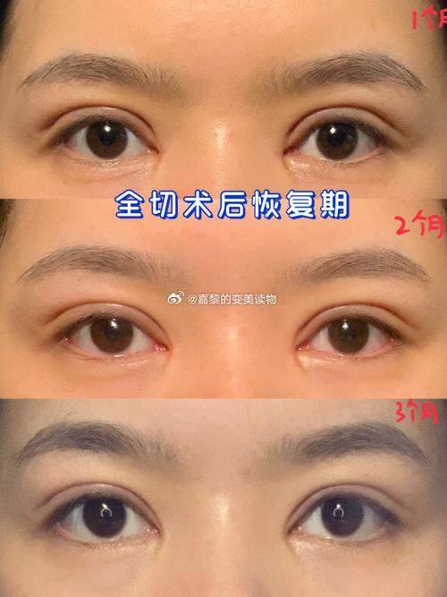 重庆铜雀台整形医院价格表：