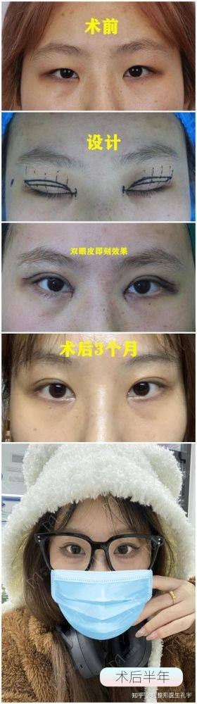 韩国忠清南道狎鸥亭line整形外科预约挂号方式