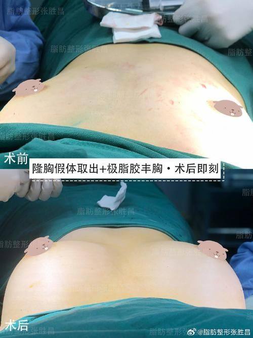 新疆维吾尔自治区人民医院整形科医生名单及擅长领域：