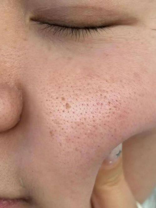 韩国noblesse整形外科预约挂号方式：