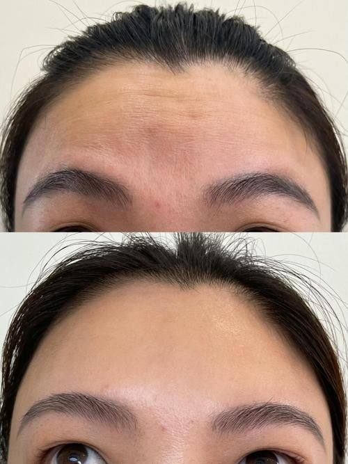 蚌埠多妍医疗美容门诊部怎么样？