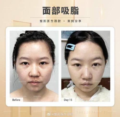 海南海口星颜悦色整形医院价格表