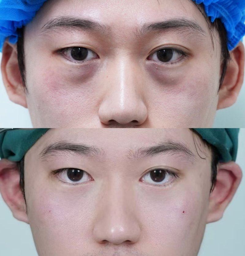 四、影响外观的皮肤与组织后遗症