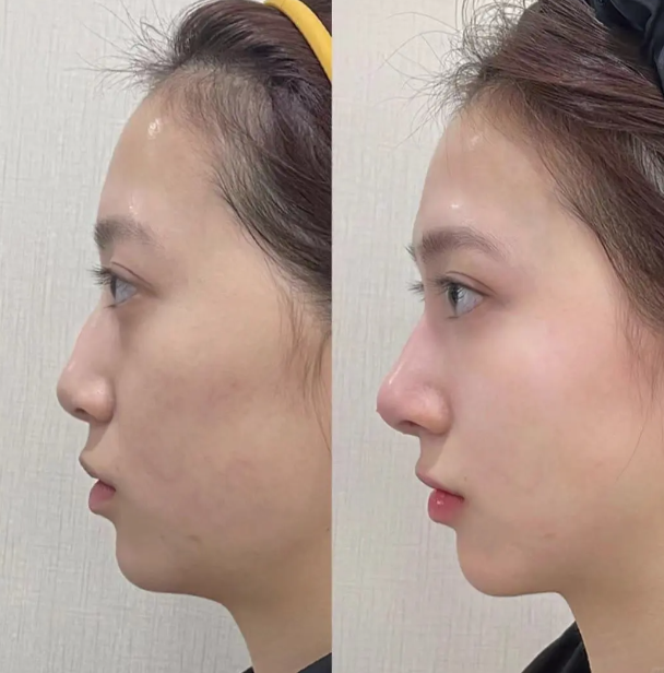 南宁韩成医疗整形美容口碑评价：