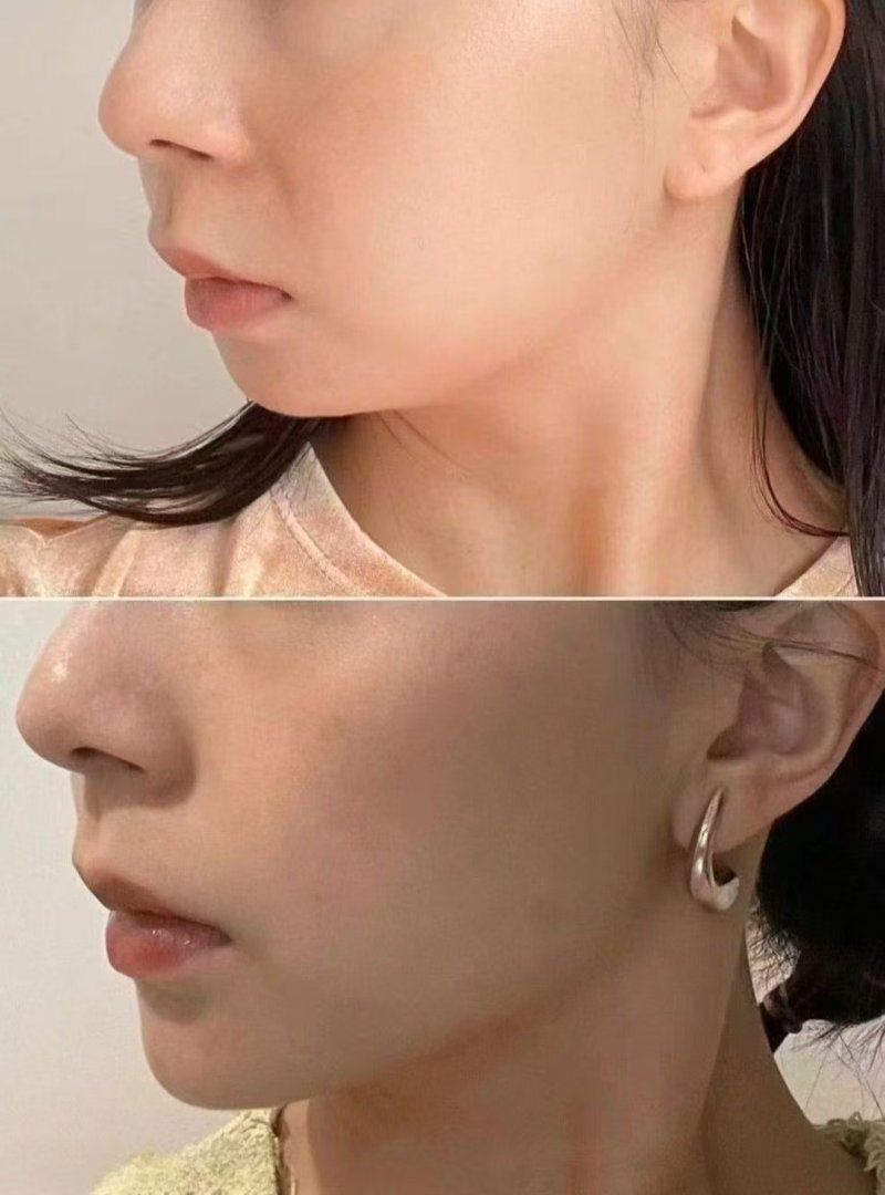 新疆维吾尔自治区人民医院整形科预约挂号方式：