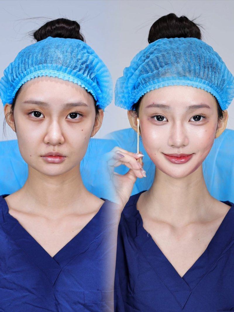 五、易被忽略的长期隐患与复胖问题