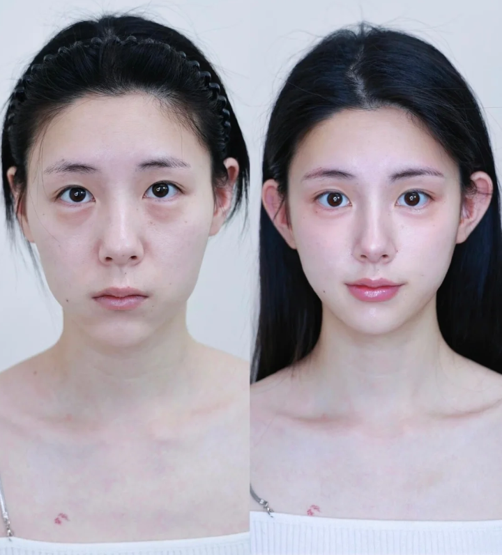 蚌埠多妍医疗美容门诊部擅长项目：