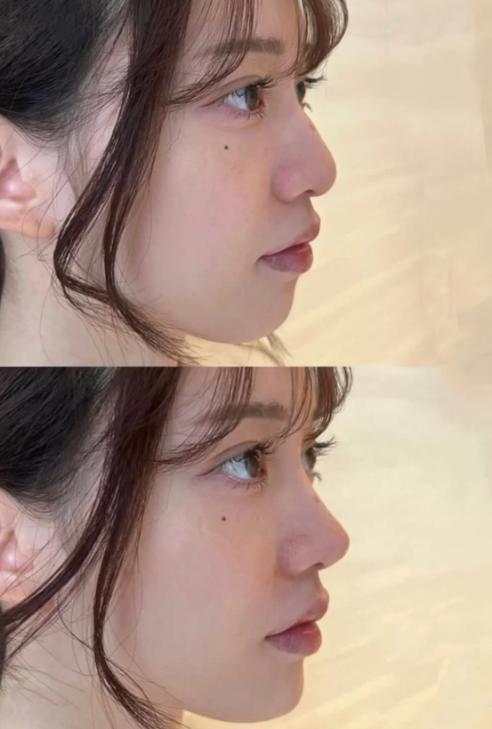 四、术后不同阶段久肿的判断与应对